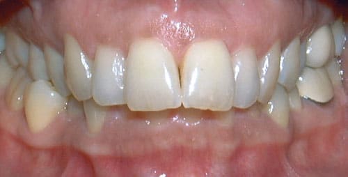 Overbite Beam Orthodontics in Sugar Land, TX